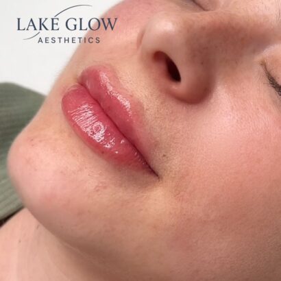 Lake Glow Aesthetics Lindau