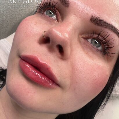 Lake Glow Aesthetics