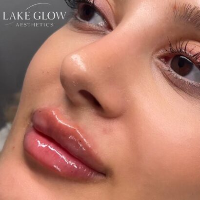 Lake Glow Aesthetics